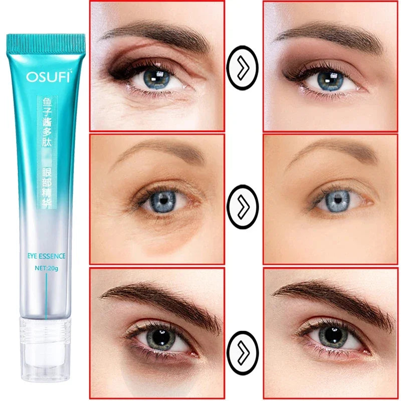 Eye Bag Cream 7 Days Anti Wrinkle Remove Puffiness Dark Circles Puffiness Firming Smooth Skin Care Moisturising Massage Essence